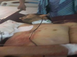 مقتل شقيق المخلافي واصابة نجل رئيس الاصلاح وقيادي في “حسم”..تفاصيل معارك “الاخوة” في تعز