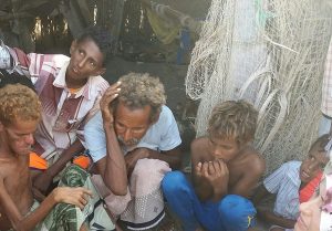 الأمم المتحدة: خطر الموت جوعا يتصاعد في اليمن