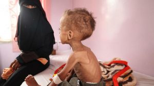 الأمم المتحدة تقول أنها تسابق الزمن لمنع المجاعة في اليمن