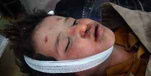بالصور: خمسة ضحايا بينهم طفلين وامرأة..طيران التحالف في مواجهة مع أطفال اليمن