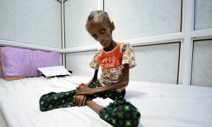 الأمم المتحدة: اليمن يتجه نحو كارثة انسانية عالمية وطفل يمني يموت كل 10 دقائق