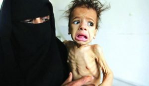 صحيفة فرنسية: اليمن..عوز متفاقم للمساعدات ومجاعة وشيكة!