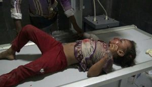 طائرات التحالف تقصف منزلاً بتعز فوق ساكنيه وسقوط 13 قتيلاً وجريحاً بينهم أطفال