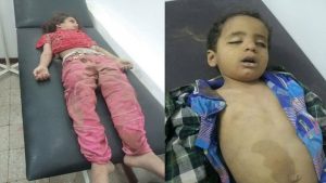 طيران التحالف يقصف منزل مواطن بصنعاء ويقتل زوجته وأطفاله (صور+أسماء الضحايا)