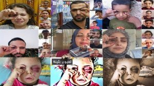 #بثينه_عين_الانسانية: شاهد آلاف الصور .. طفلة يمنية تفتح عيون نشطاء وأطفال العالم على اليمن
