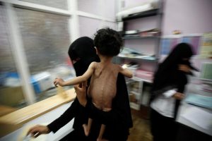 هيومن رايتس: الحصار يخنق اليمنيين