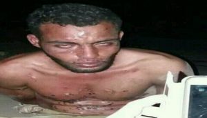 وسائل تعذيب جديدة..شاهد ماذا فعل الضباط الإماراتيون بمعتقل يمني في المخا