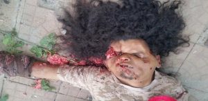 اغتيال قائد جبهة قلعة القاهرة والكشف عن مؤامرة لتصفية جماعة أبوالعباس في تعز (صور)