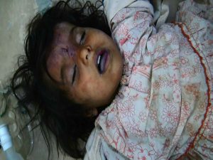 22 قتيلاً معظمهم نساء وأطفال بغارات للتحالف استهدفت منازل وسيارات مواطنين في صعدة