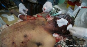 مجزرة جديدة في صعدة: طيران التحالف يقتل 15 مدنياً ويصيب 3 آخرين