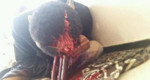 مجند بفصائل التحالف في تعز يقرر الانتحار احتجاجاً على حرمانه من مرتبه (صورة)