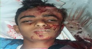 مقتل طفل يبيع الشاي وشخص آخر جراء مواجهات بين مسلحي فصائل التحالف وسط مدينة تعز (أسماء+صور)