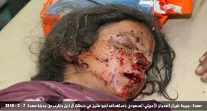 اليمن..طيران التحالف يرتكب مجزرة في العاصمة صنعاء ضحيتها أسرة مكونة من 10 أطفال ونساء ومجزرة أخرى في صعدة