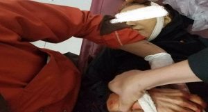 مقتل امرأة باشتباكات فصائل التحالف في مدينة تعز وإغلاق المستشفى الجمهوري