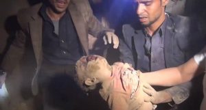 بالصور: 24 شهيداً وجريحاً بينهم نساء وأطفال في حصيلة أولية لمجزرة طيران التحالف في مدينة عمران