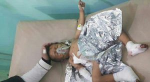 غارات التحالف توقع 16 شهيداً وجريحاً معظمهم أطفال في الحديدة وصعدة وعمران
