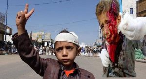 اليونسيف تدعو إلى التحرك لحماية أطفال اليمن وتطالب بوقف الغارات الجوية