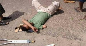 شاهد صورة مقاتل بترت ذراعه أثناء قتاله مع التحالف يتعرض للضرب في عدن لمطالبته بحقوقه