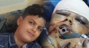 أمن محافظة إب يلقي القبض على قاتل الطفل عبدالرحمن عطران