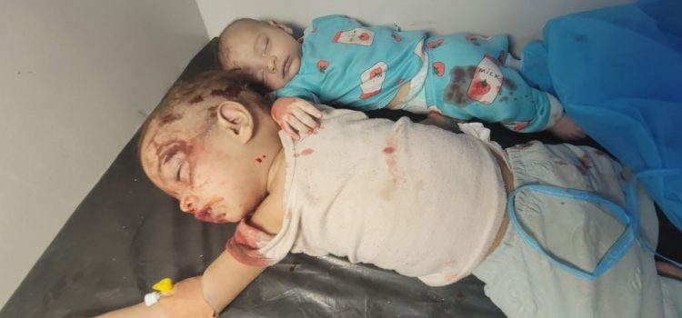 منظمة حقوقية في تعز تدين جر ائم العدو السعودي بعد استهداف مدرسة وأعيان مدنية في حيفان