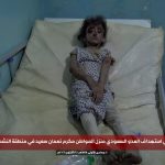 العدو السعودي يرتكب جريمة جديدة في تعز: شهيد وإصابة امرأة و3 أطفال كحصيلة أولية