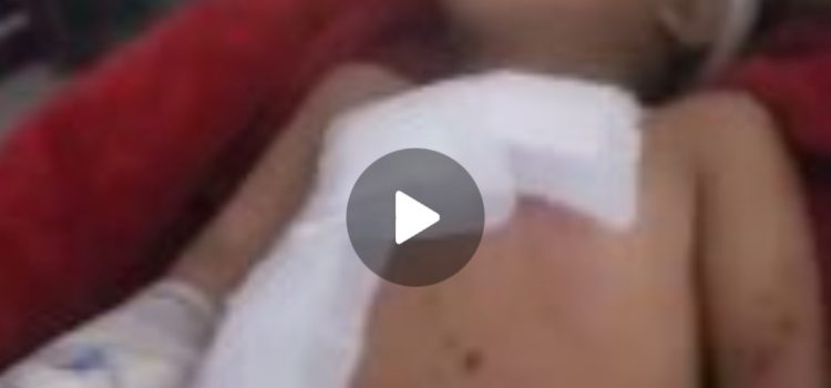 ارتفاع حصيلة القصف السعودي بالقنابل المحرمة دولياً على منازل المواطنين بذمار إلى 14 شهيداً وجريحاً (مُحدّث)